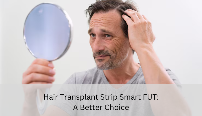hair transplant strip smart fut